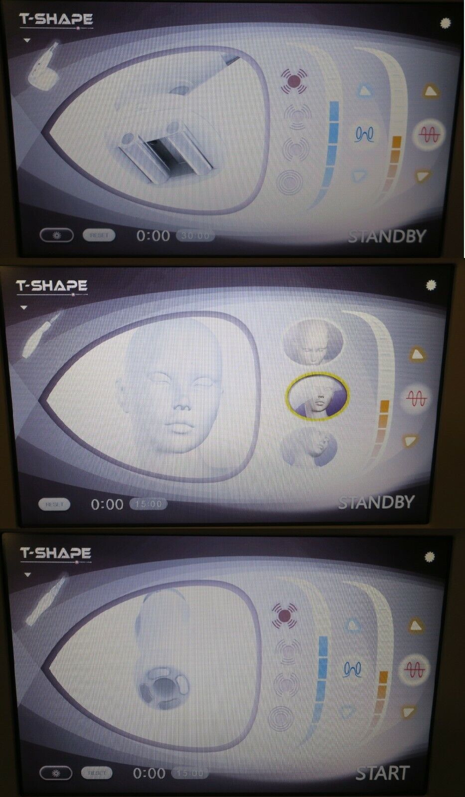 Baldan T-Shape 3in1 Multisystem RF Multipolare Fat Cellulite Skin Beauty Machine