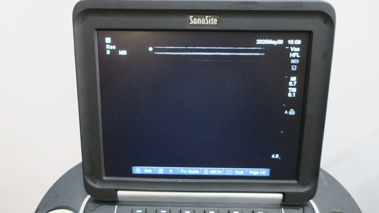 SonoSite Edge Portable Ultrasound 2D MMode Doppler P1500063 + HLF38x/136Mhz19
